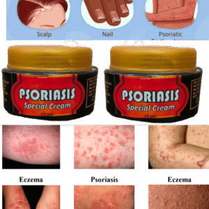 Psoriasis special cream pack of 2