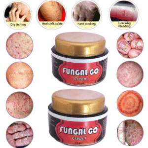 Fungal go cream pack of 2
